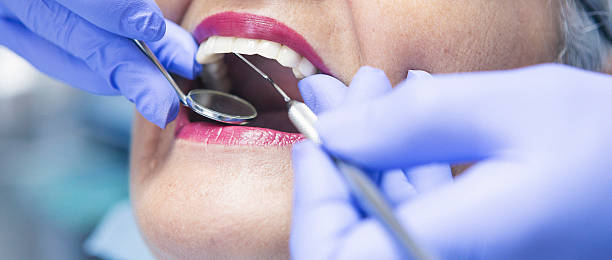 Best Emergency Treatment for Toothache in Northwest Harborcreek, PA